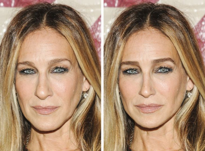 4. Sarah Jessica Parker has got her lips and nose done in the second picture