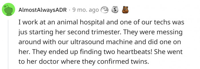 This woman accidentally found out she was carrying twins!