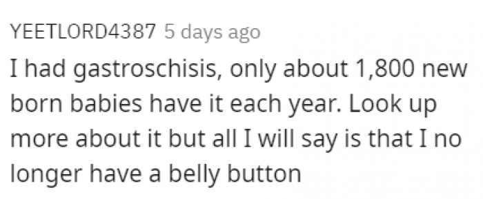 23. The curious case of this man's belly button