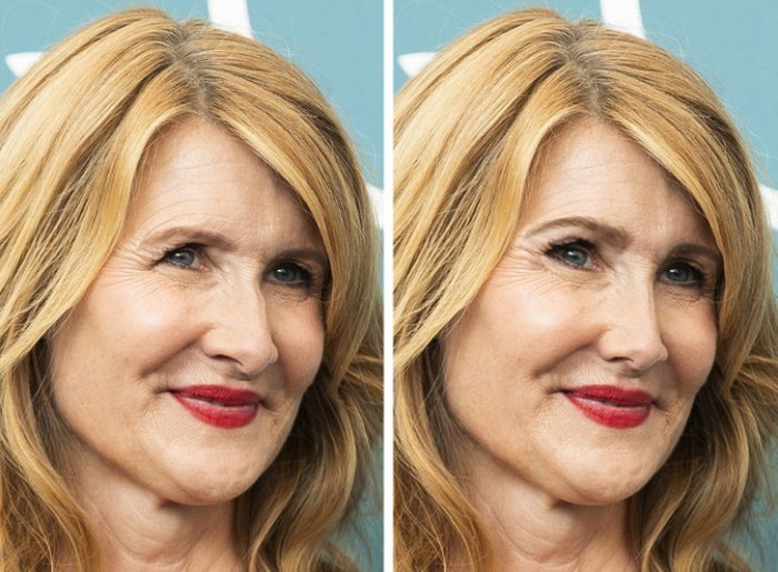 10. Laura Dern has got her brows and nose done nicely