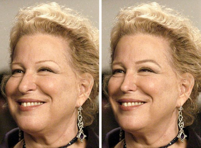 5. Bette Midler has got her face toned and her brows lit