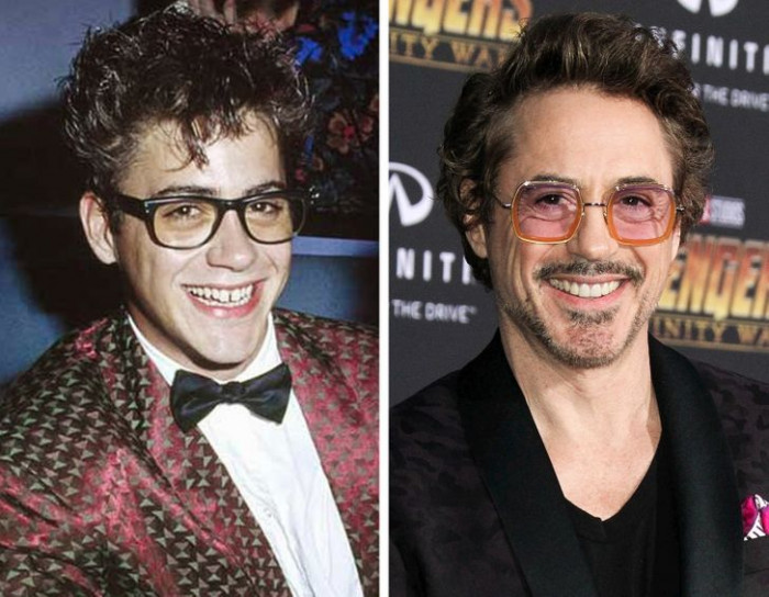 5. Before and after of Robert Downey Jr.