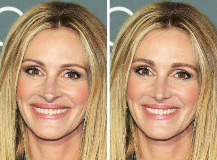 19. Julia Roberts has got her eye brows, nose and smile popping