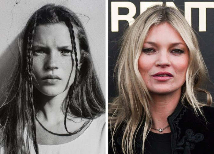 20. Kate Moss's before and after