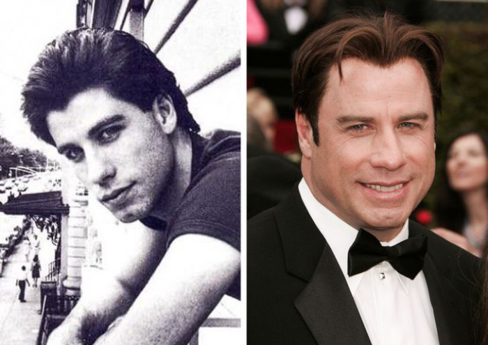 17. John Travolta's before and after