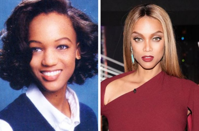 31. Tyra Banks' before and after