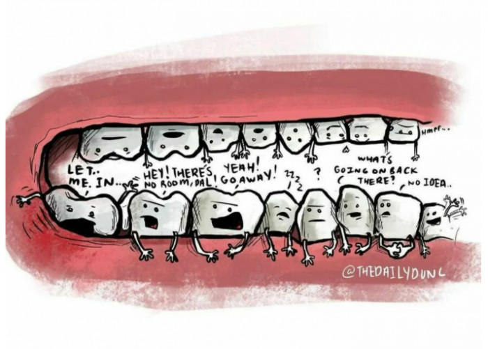 Every new tooth tries to fit in, either make space or get toothaches!