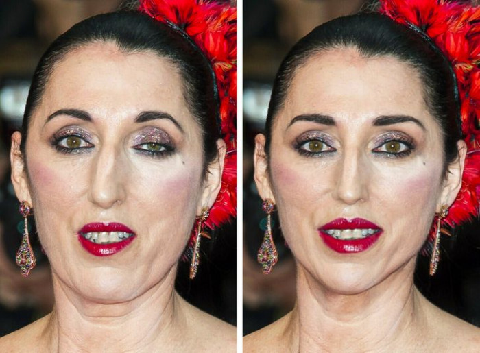 3. Rossy de Palma has got her whole face restructured in the second picture