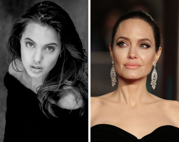 15. Angelina Jolie's before and after