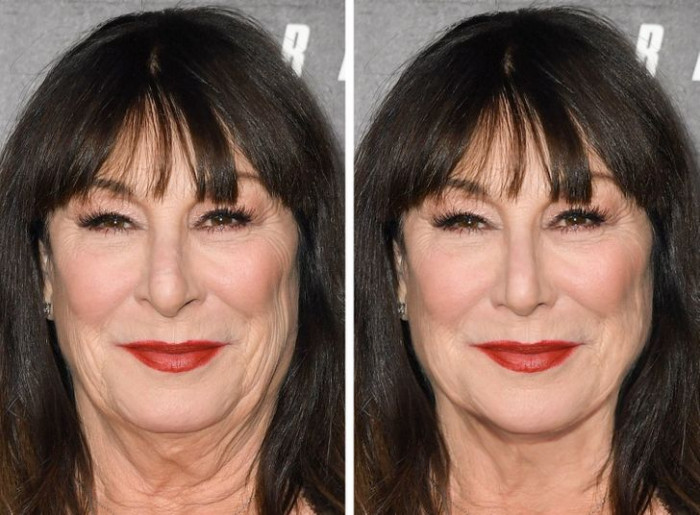 6. Anjelica Huston has got her nose, lips and neck lines fixed better