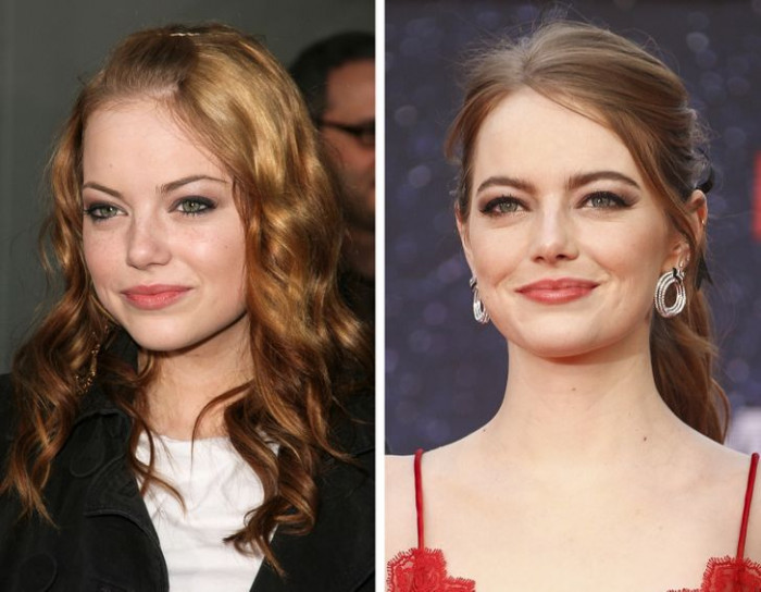 33. Emma Stone's before and after