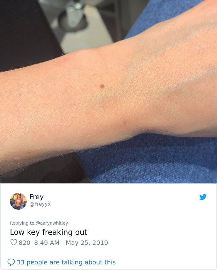 And before long, women everywhere began sharing their own wrist freckles.