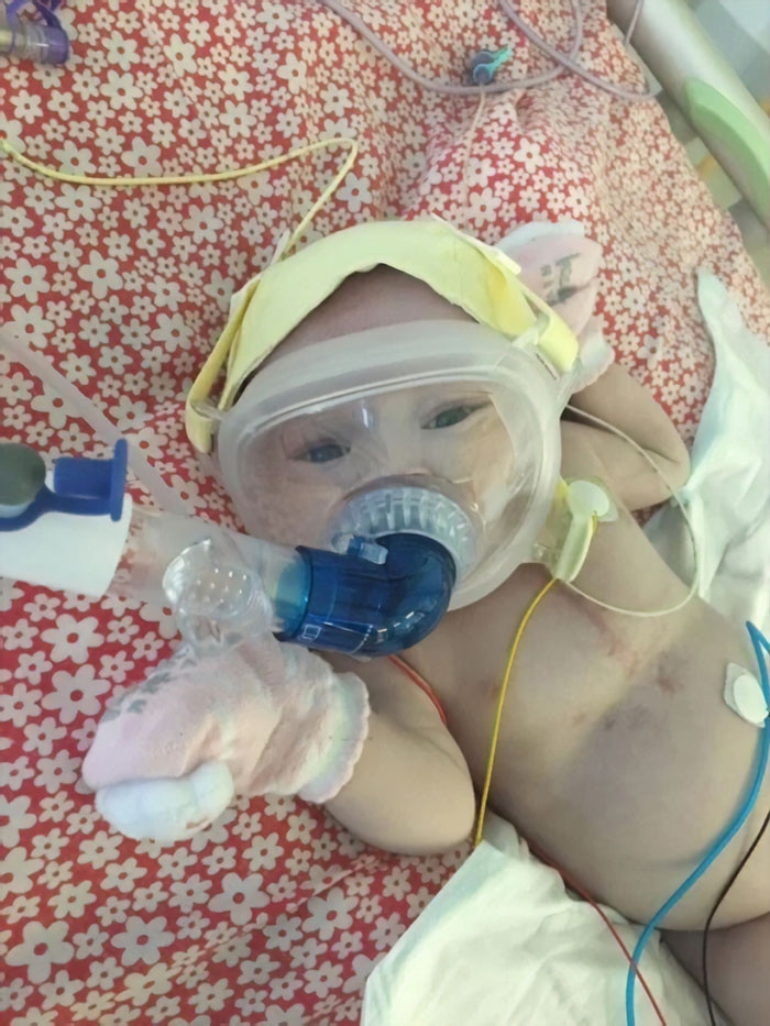 Erin managed to beat COVID-19 after being admitted to intensive care and in post-op, despite having lung and heart problems.