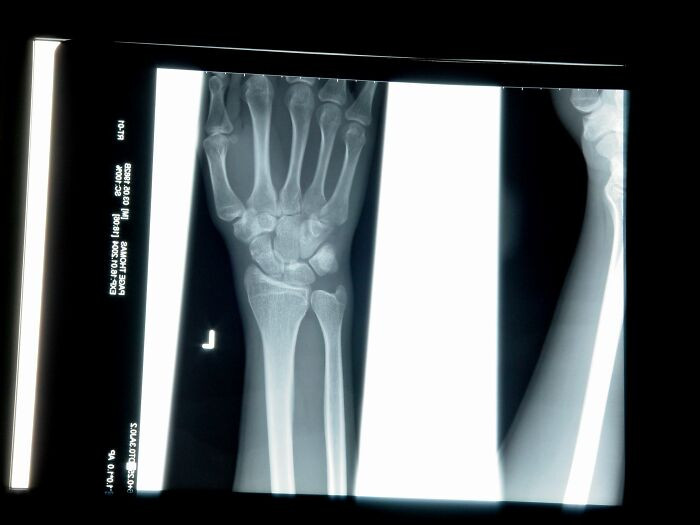 It's game over! The plaintiff was an x-ray tech at another hospital.