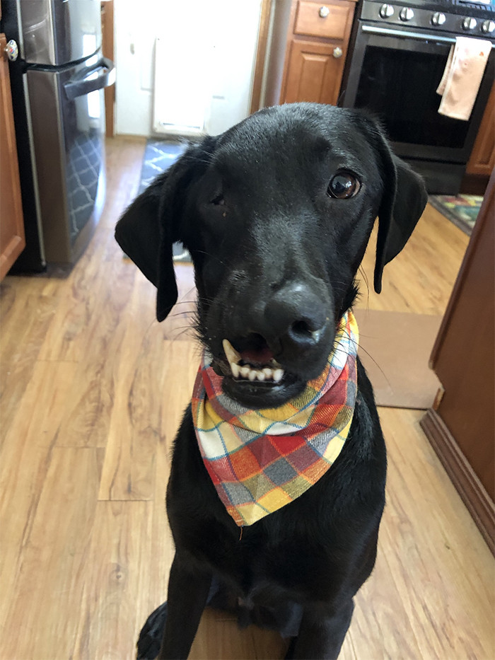 Felix was born with a split lip and split palate