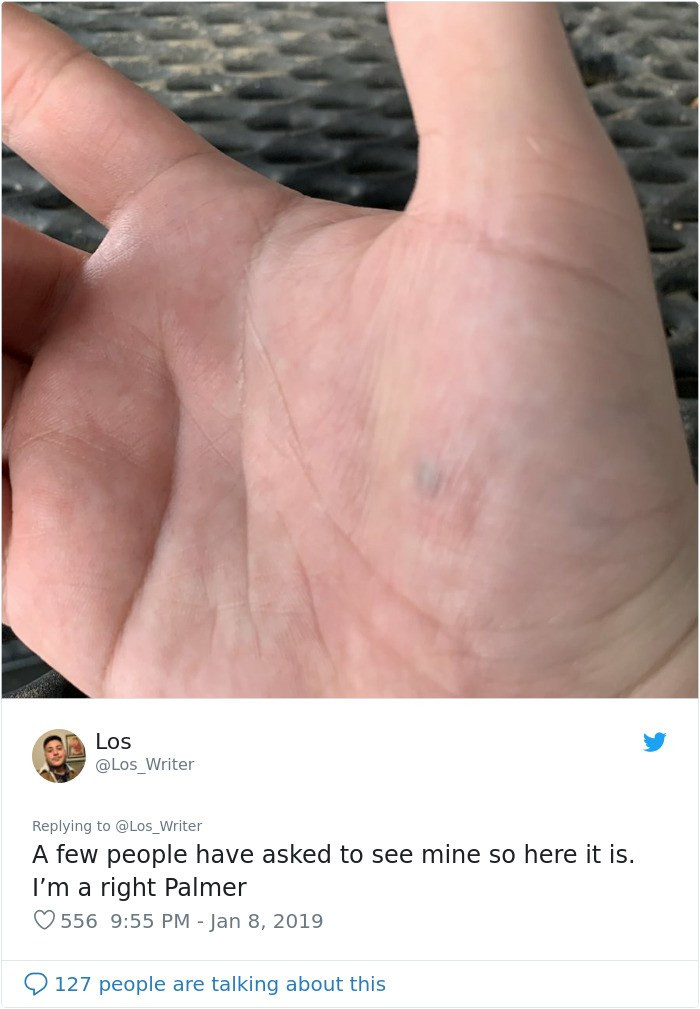 Twitter Thread Proves A LOT Of People Have Permanent Scars From Lead ...