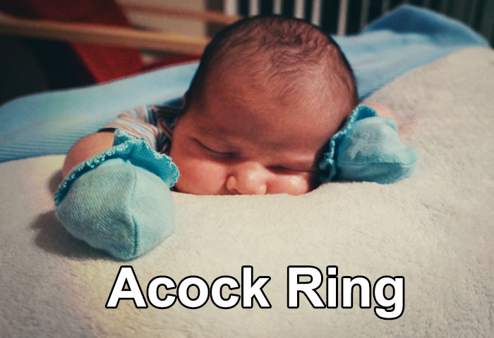 17. Acock Ring