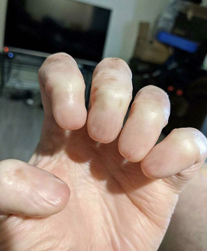 48. Nail-less Fingers