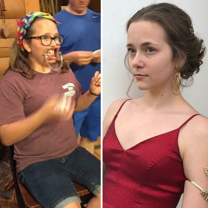 28. The Defeat of Hard-Hit Puberty