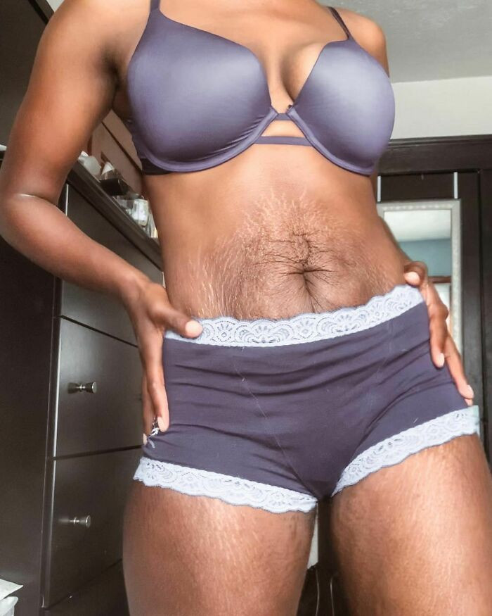 28 Raw Images Of What A Postpartum Body Looks Like For Most Women Despite  What Instagram May Have You Believe