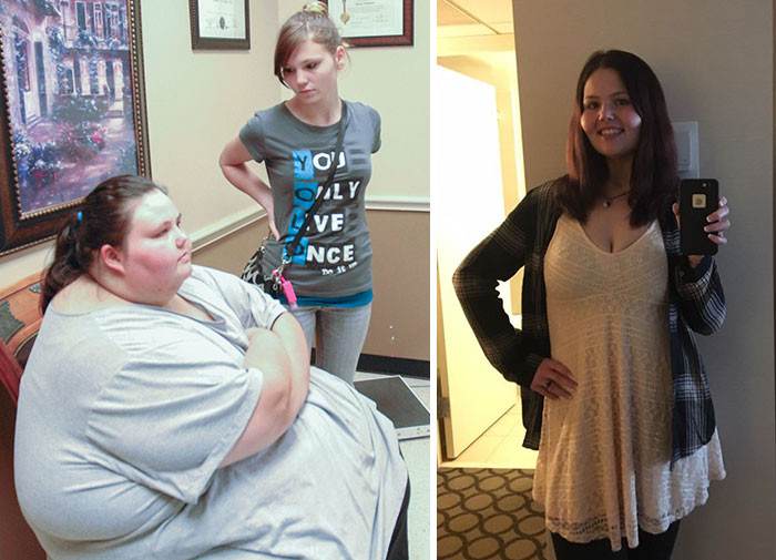 Amazing Before And After Weight Loss Photos From Women Who Were Morbidly Obese