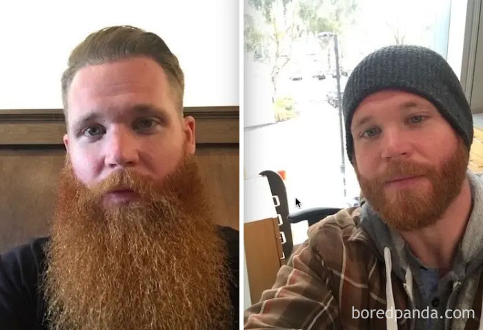 5. This guy had to sacrifice his 4 year beard for work