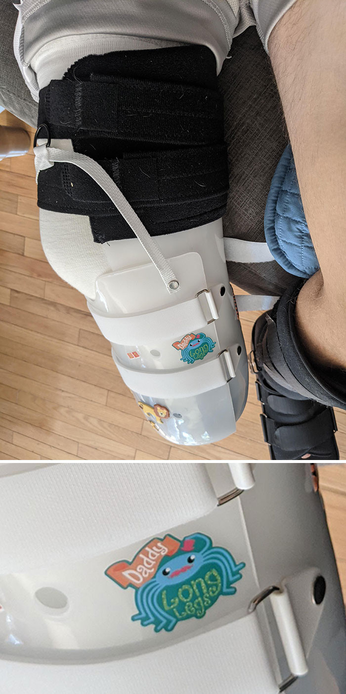 23. Lost my foot due to an accident, and my son decorated my brace with this sticker