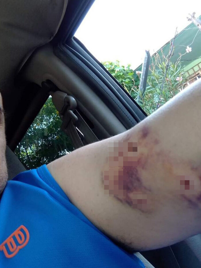 The dog was afraid and reacted out of fear.