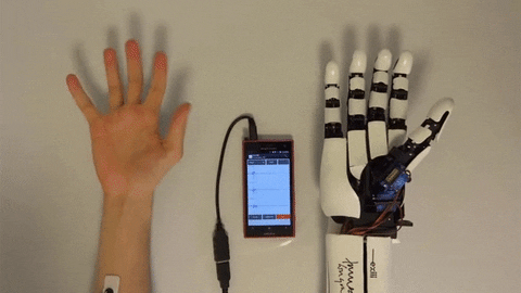 For everyone who doesn't know- this is what a bionic prosthetic arm looks like. This one is controlled by a smart phone, but not all of them are.