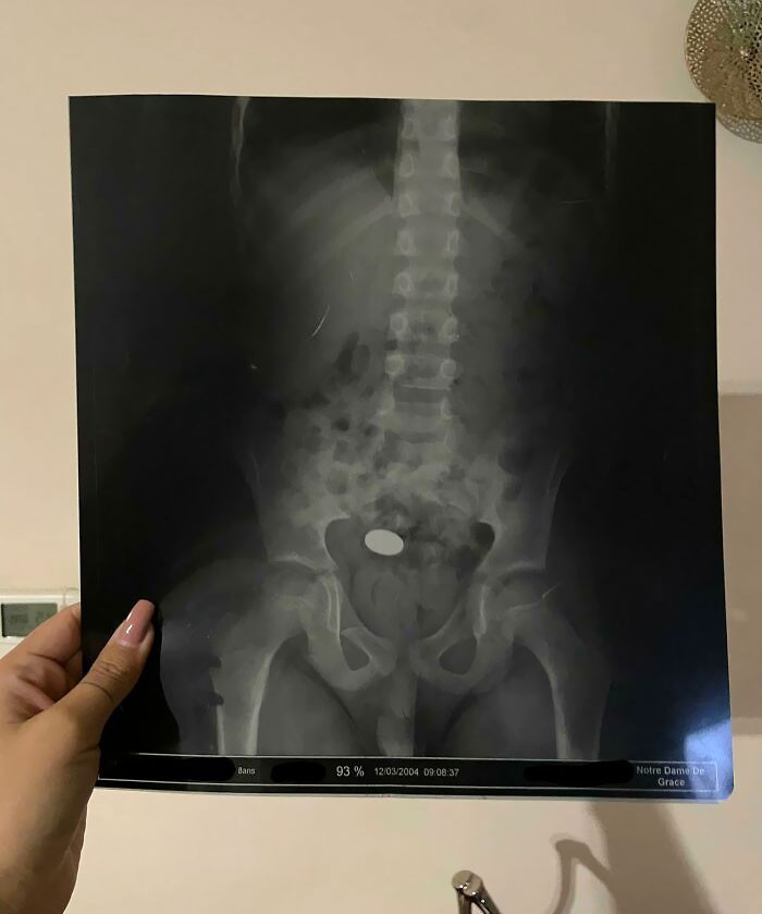 12. At 8 years old, I became a piggy bank as €0.10 was about to be debited