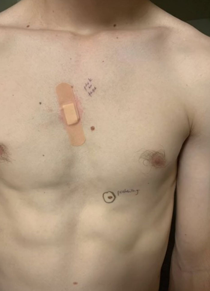 She wrote next to each mole whether it looked fine or would need to be taken for testing.