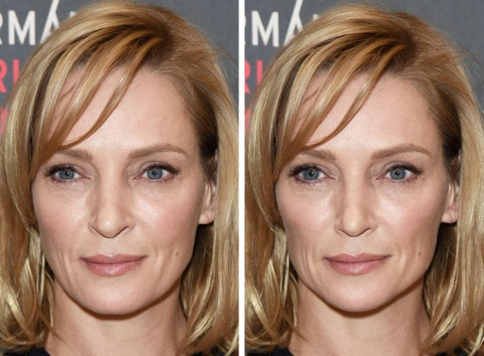 17. Uma Thurman has got her nose done