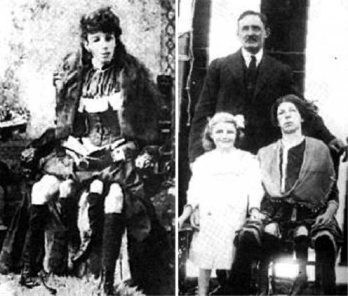 Josephene Myrtle Corbin Four-Legged Girl with her husband and daughter