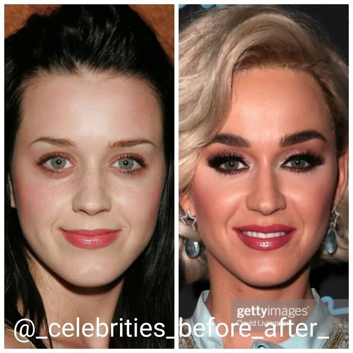 4. Katy Perry's before and after photos