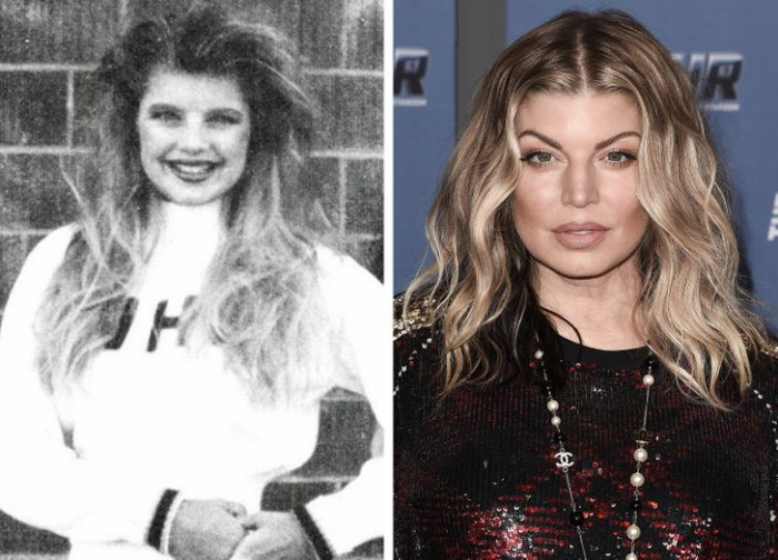 30. Fergie's before and after