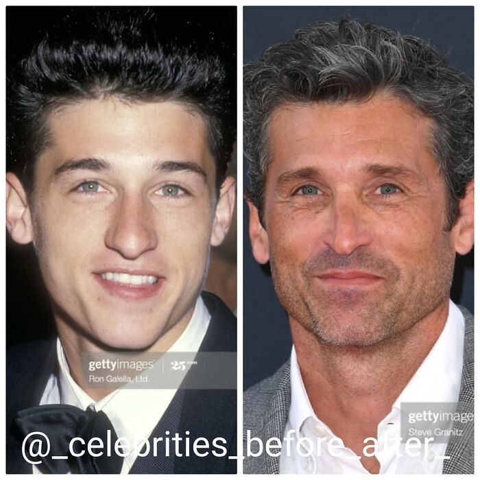 5. Patrick Dempsey's before and after photos