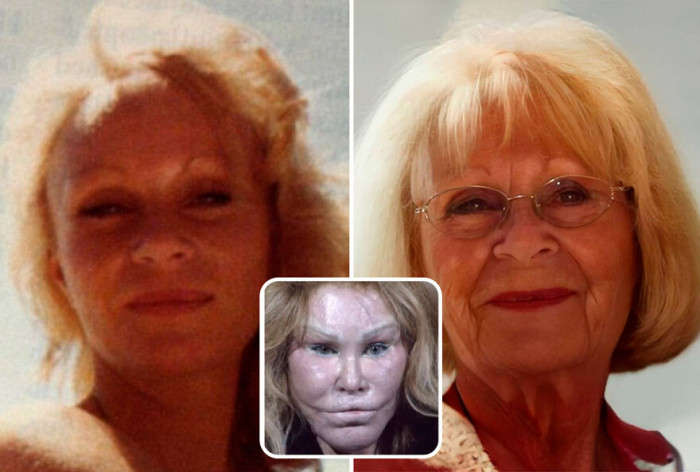 15. Jocelyn Wildenstein, 81 Years Old