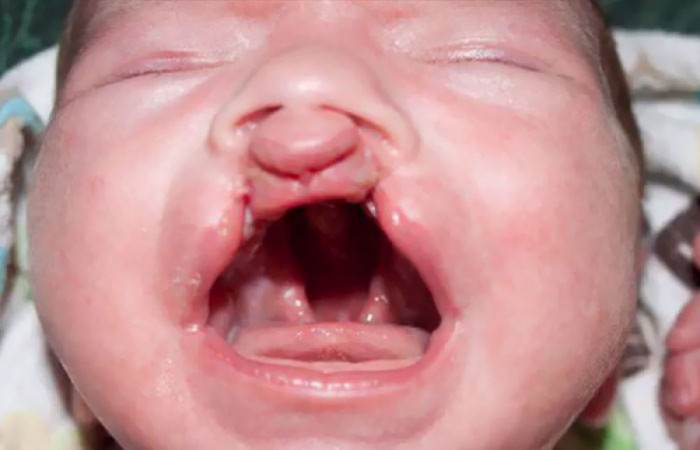 And He Will Most Likely Have to Go Through More Surgeries