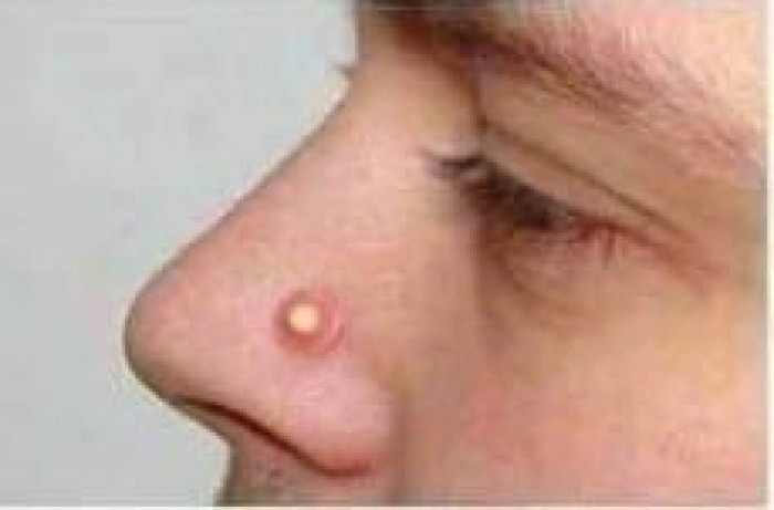 2. They're basically designed to hide the fact that you have a piercing.