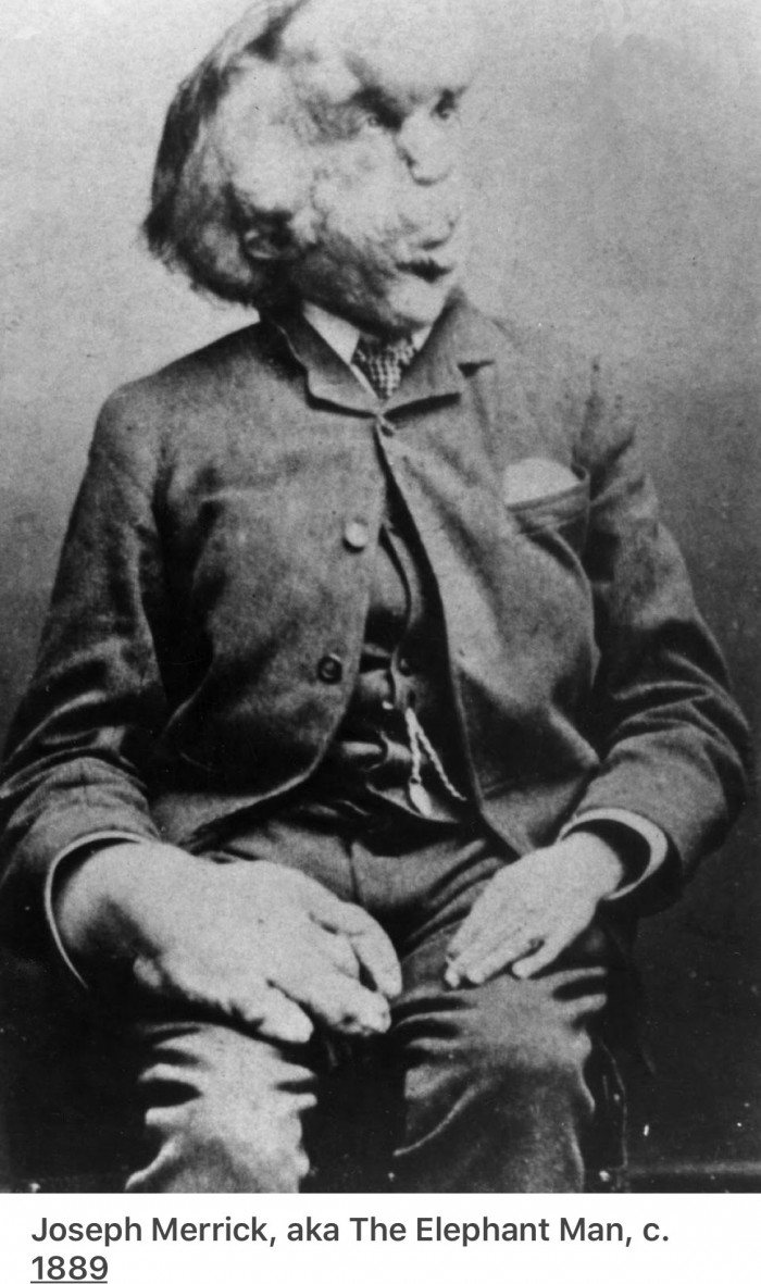 Joseph Merrick, The 