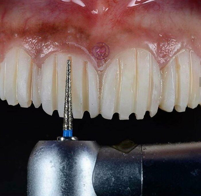 17. This is hella weird until you realize real teeth have gaps in them