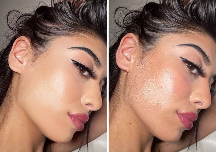 13. Skin is not always smooth