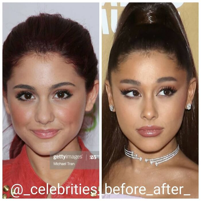 2. Ariana Grande's before and after photos