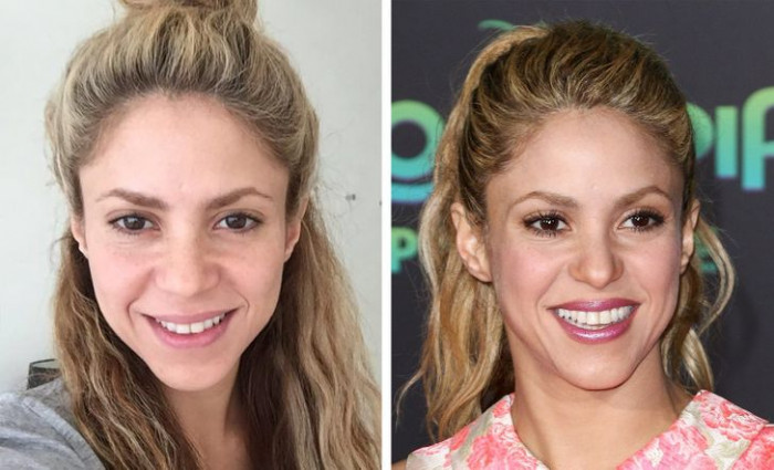 The Picture-Perfect Smile