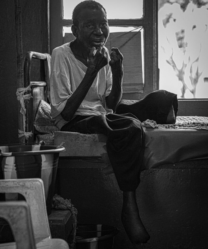 14. Hope... Leprosy. 2nd Place, Editorial