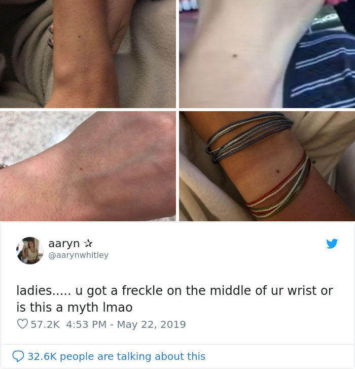 Aaryn went viral when she made the claim that every woman has the same freckle in the middle of their wrist.