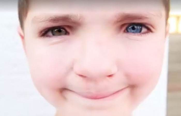 Madden Is Truly a Strong Little Boy Who Has Endured a Lot of Pain and Suffering in His Seven Years