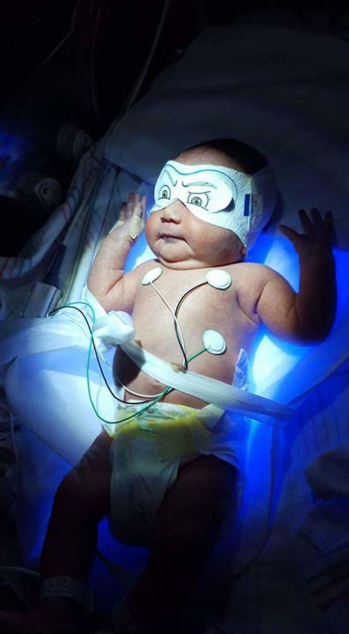 37. My newborn son has jaundice and is receiving light therapy, so I made the nurses know how he felt behind the mask
