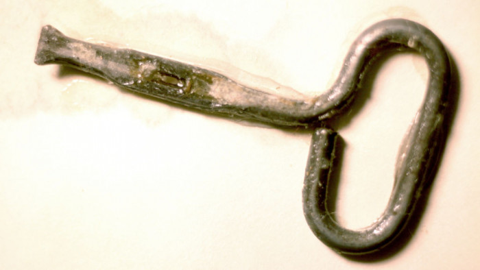 Sardine key removed from a child’s esophagus in 1942