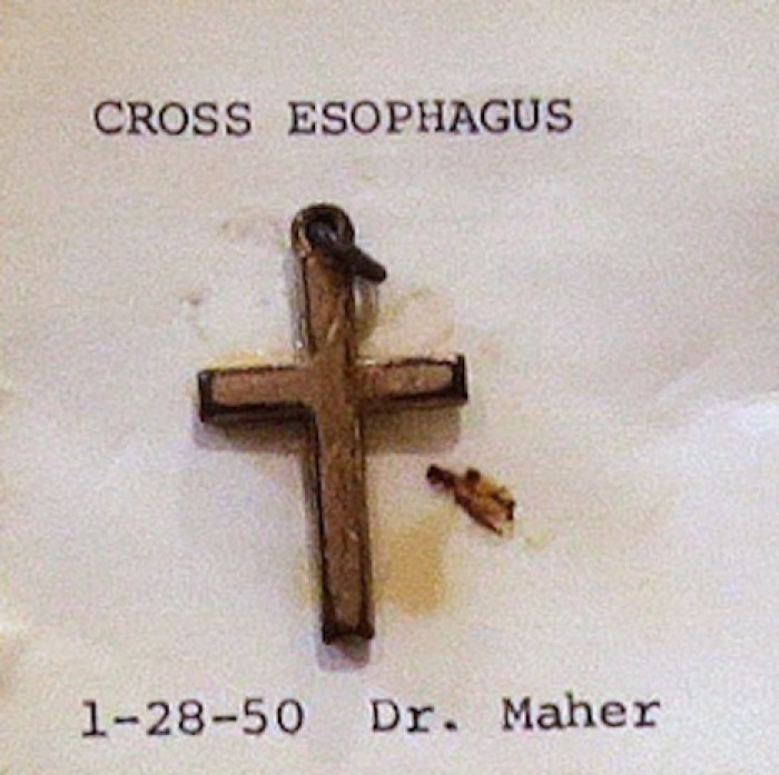 Cross removed from esophagus in 1950